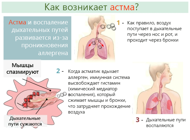 Причины возникновения астмы у человека