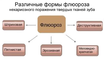 Болезни зубов: флюороз