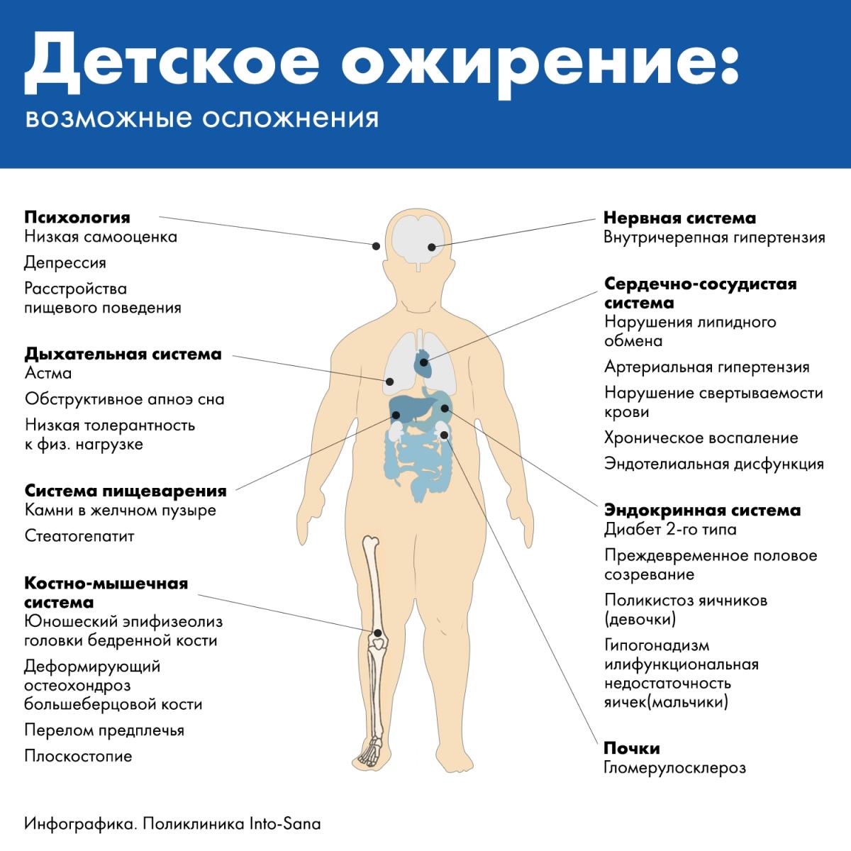 Детское ожирение и возможные осложнения