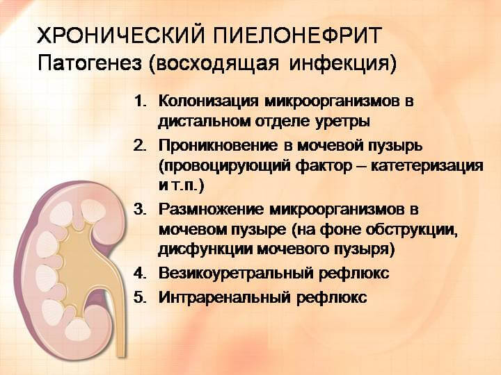 Хронический пиелонефрит почек