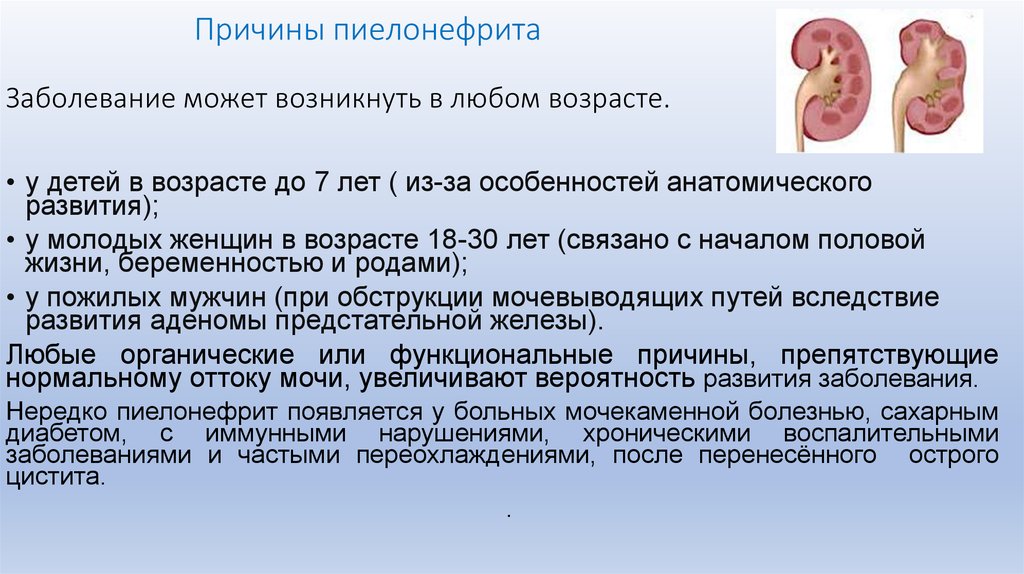 Хронический пиелонефрит почек