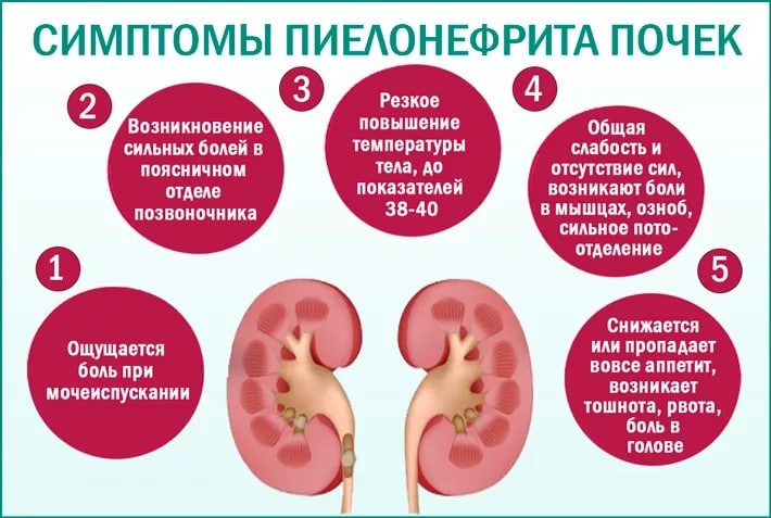 Хронический пиелонефрит почек
