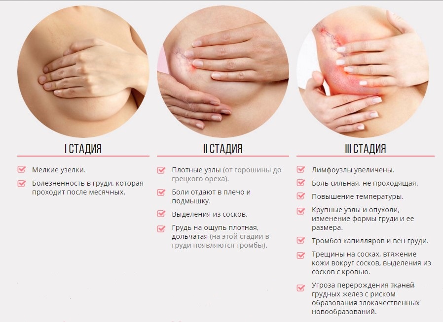 Методы лечения рака молочной железы